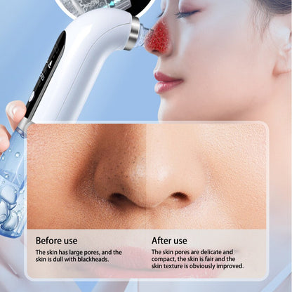 Blackhead Remover Device
