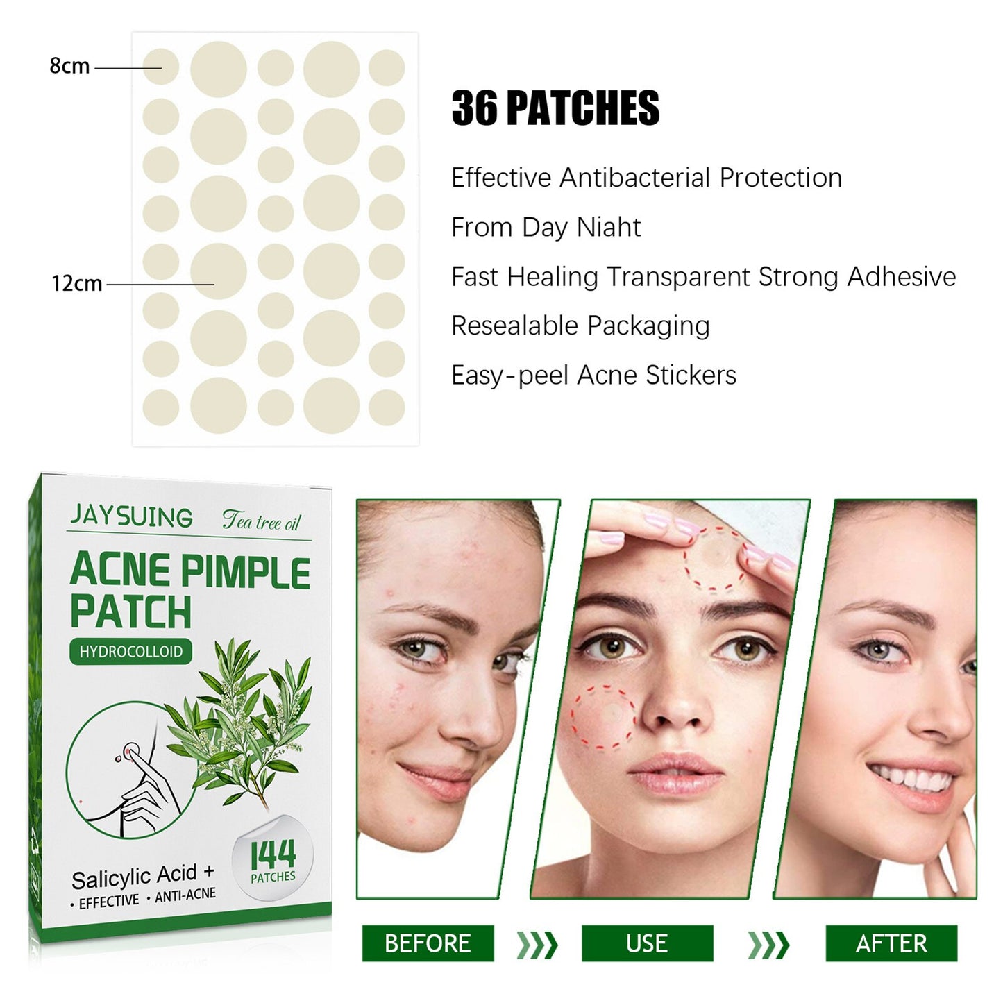 Acne Pimple Patches 144Ct
