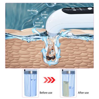 Blackhead Remover Device